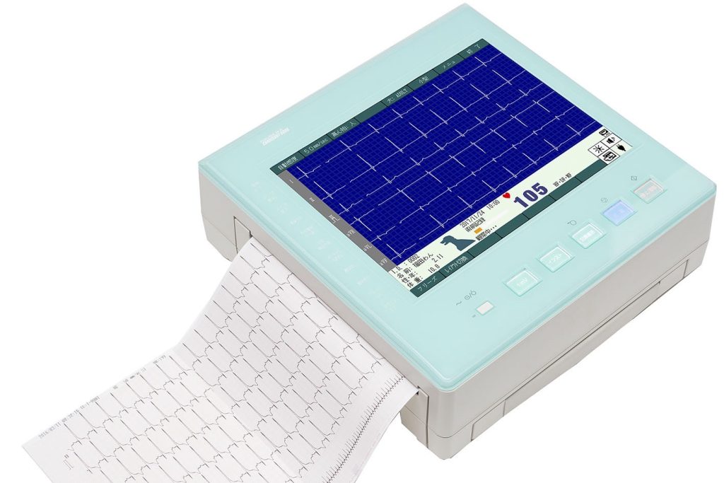 心電計